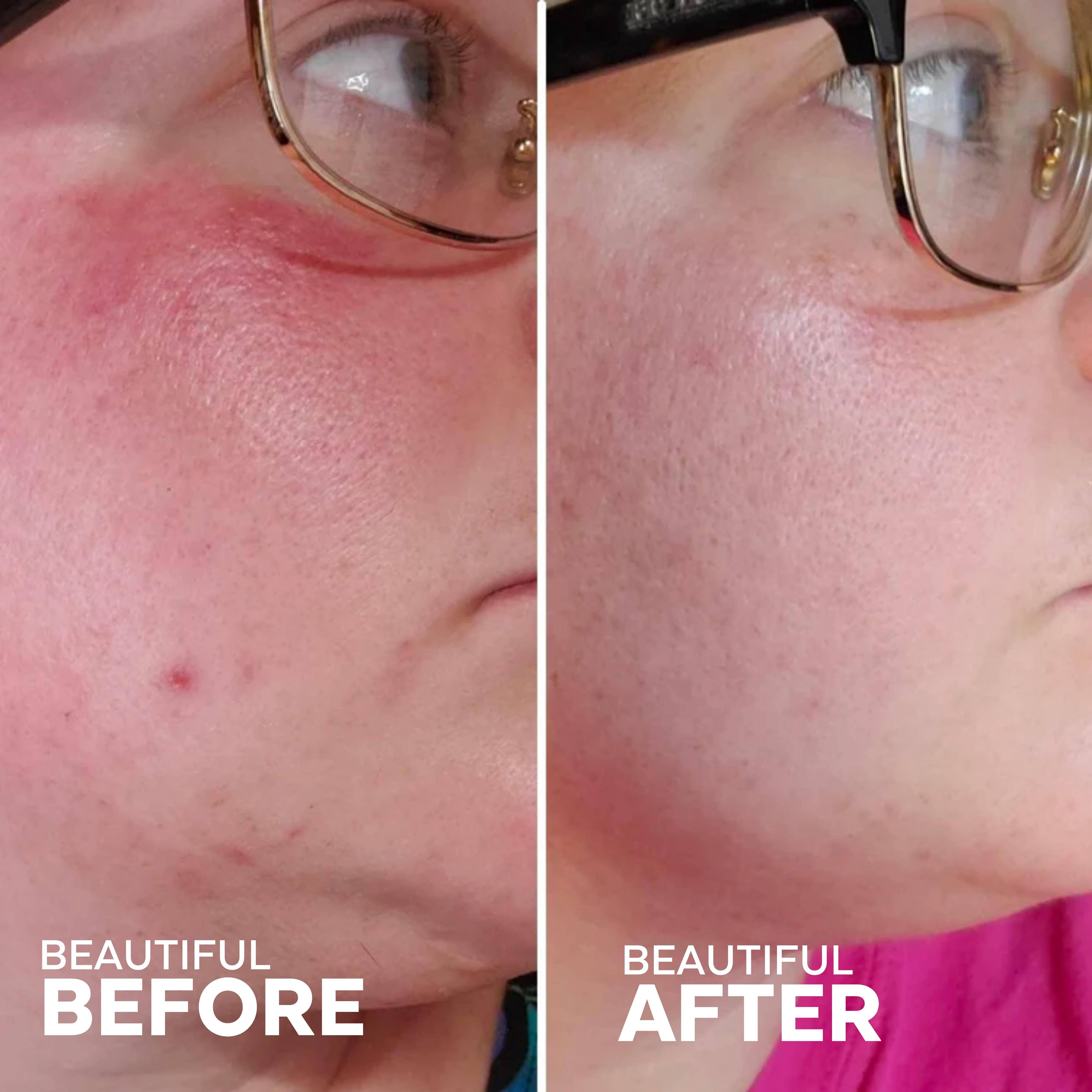 Three Ships - Radiance Grape Stem Cell + Squalane Cream (50g)