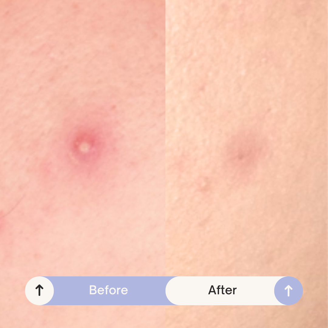 Maskeraide - Spotted Nighttime - Original Hydrocolloid Patches