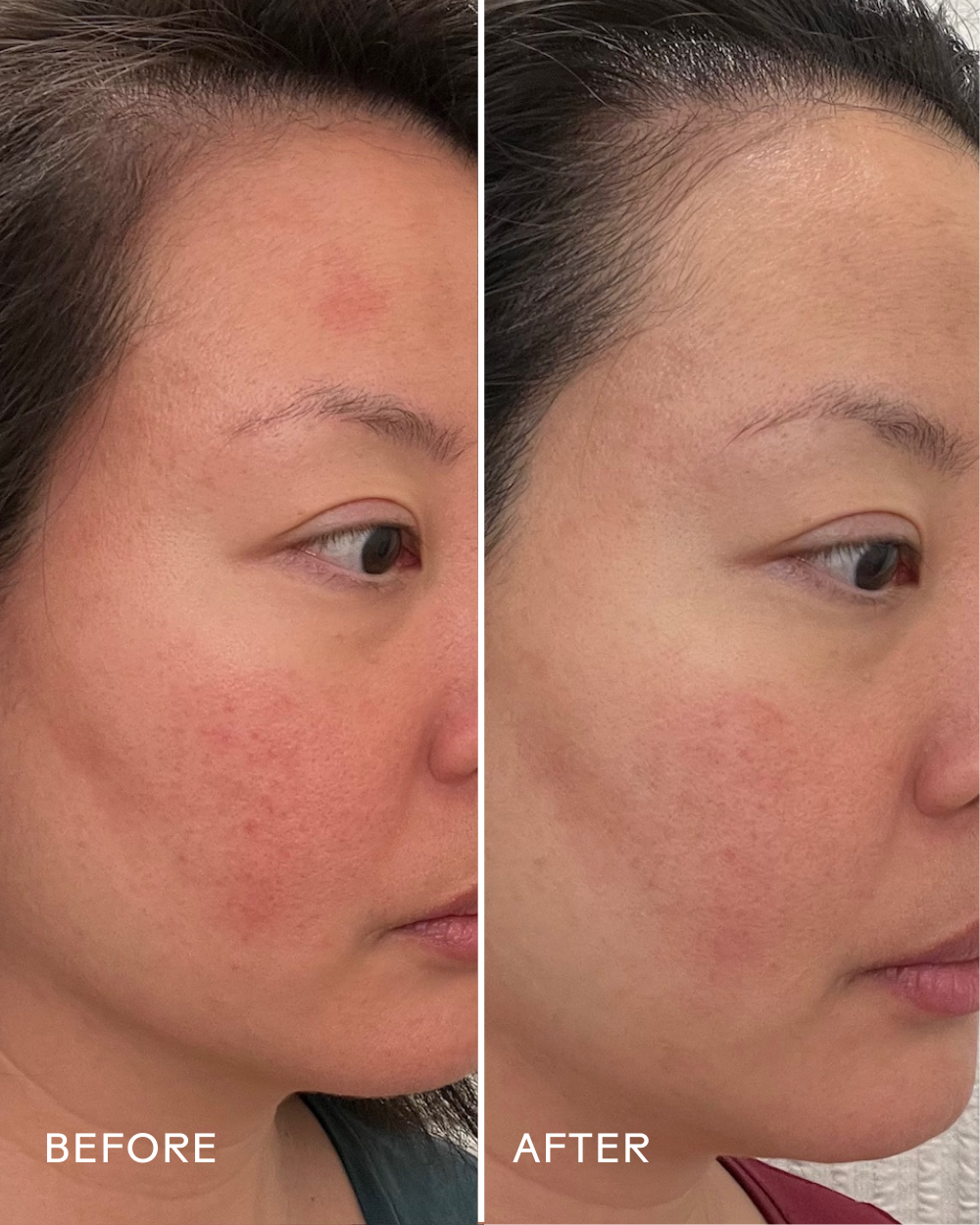 Three Ships - Replenish Ceramides + Blueberry Barrier Repair Serum