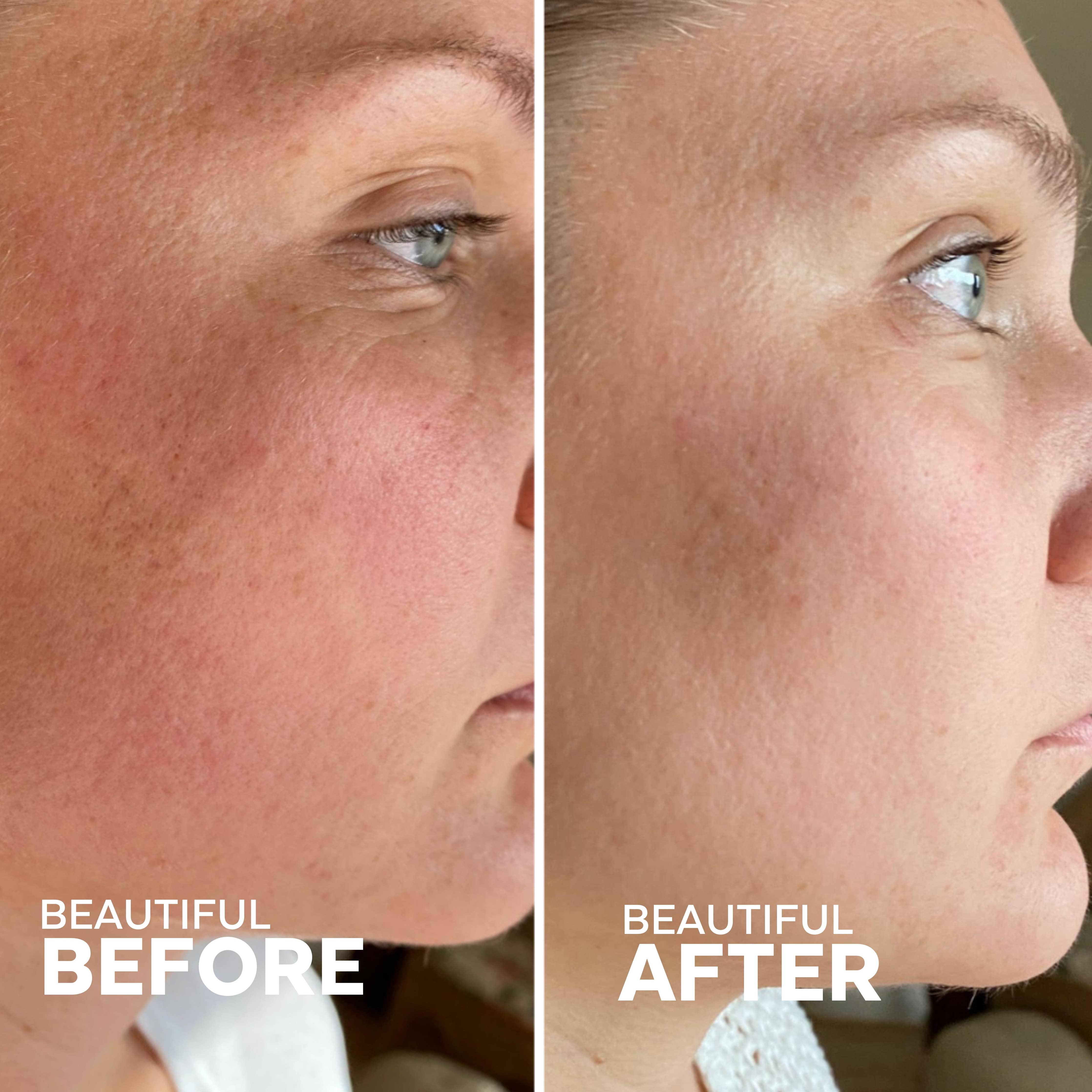 Three Ships - Skin Hero Bakuchiol + Calendula Bio-Retinol Serum (30mL)