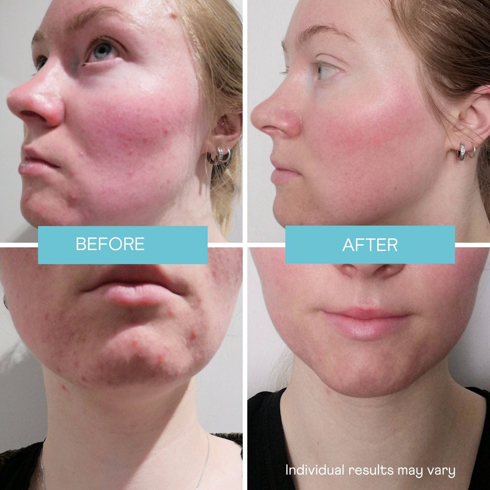 Woohoo Body - This Is Me Enzyme Exfoliating Mask: With Reusable Pump