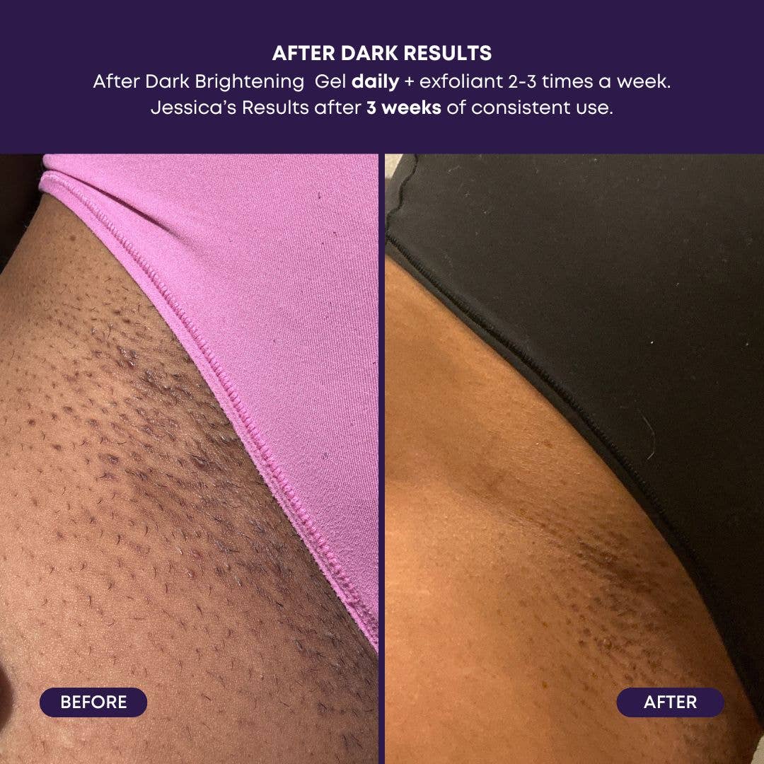 Bushbalm - After Dark Brightening Gel