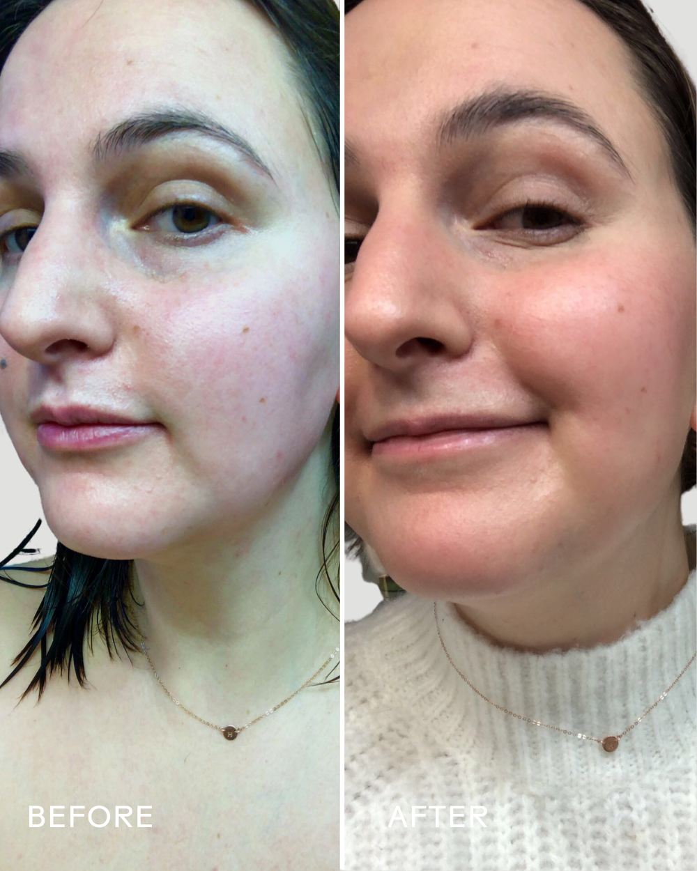 Three Ships - SkinHero™ Calendula + 2% Bakuchiol Bio-Retinol Serum