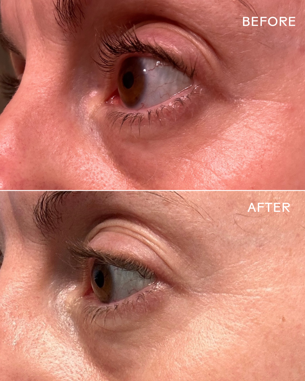 Three Ships - EyeHero™ Bio-Retinol Smoothing Eye Cream