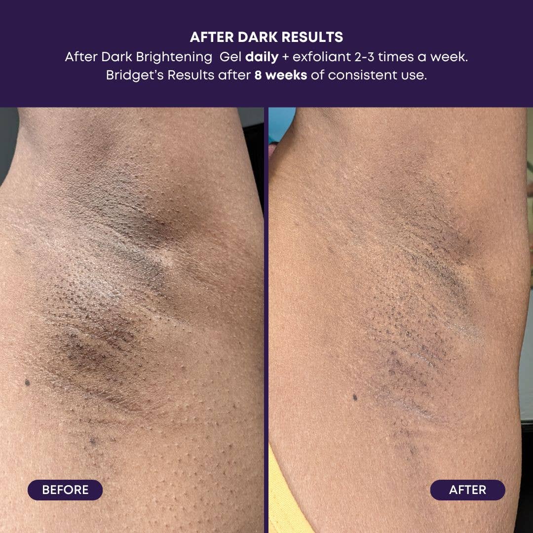 Bushbalm - After Dark Brightening Gel