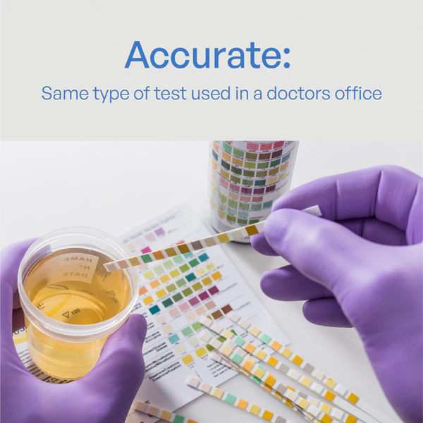 UTI Diagnostic Test Strips