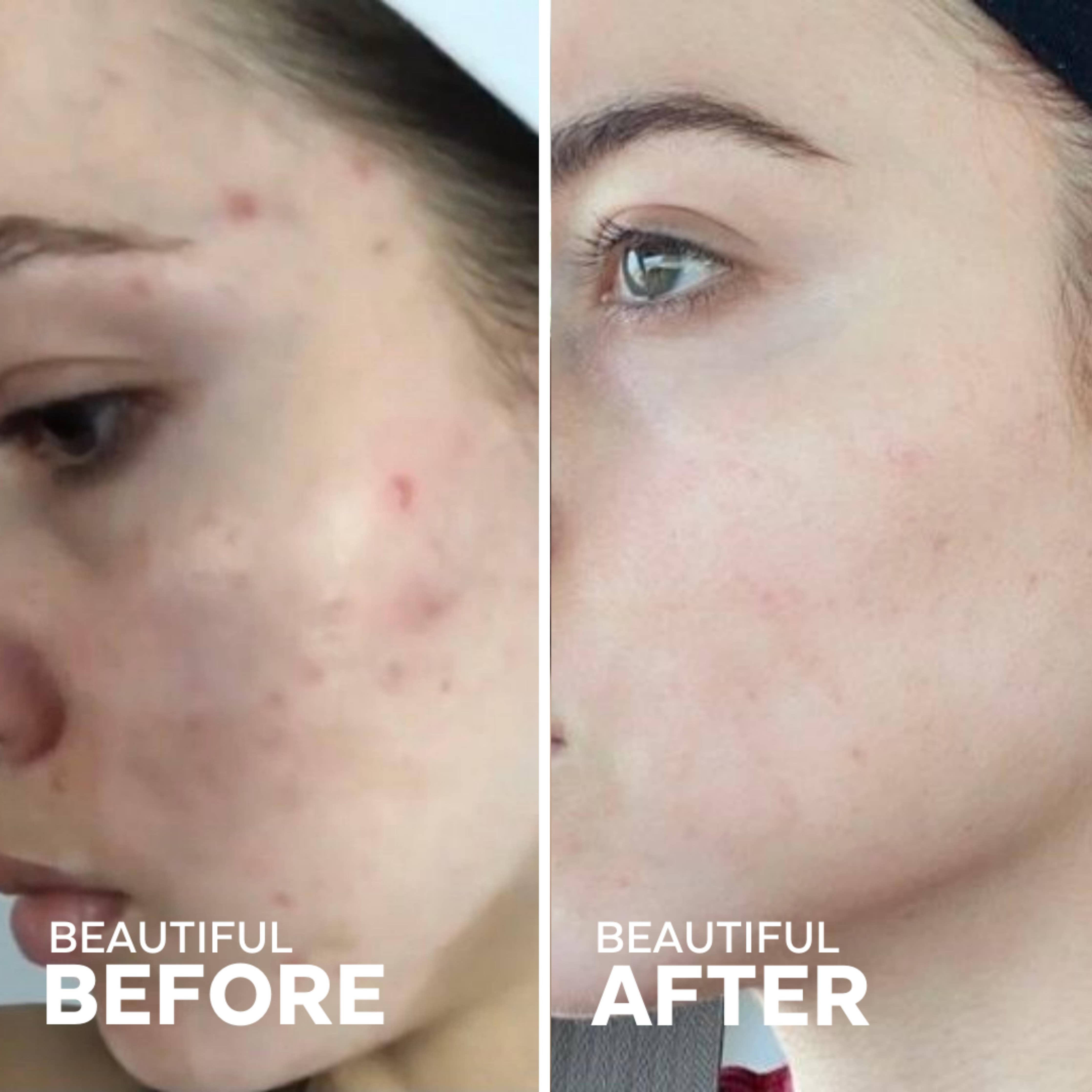 Three Ships - Dew Drops Mushroom Hyaluronic Acid + Vitamin C Serum (30mL)