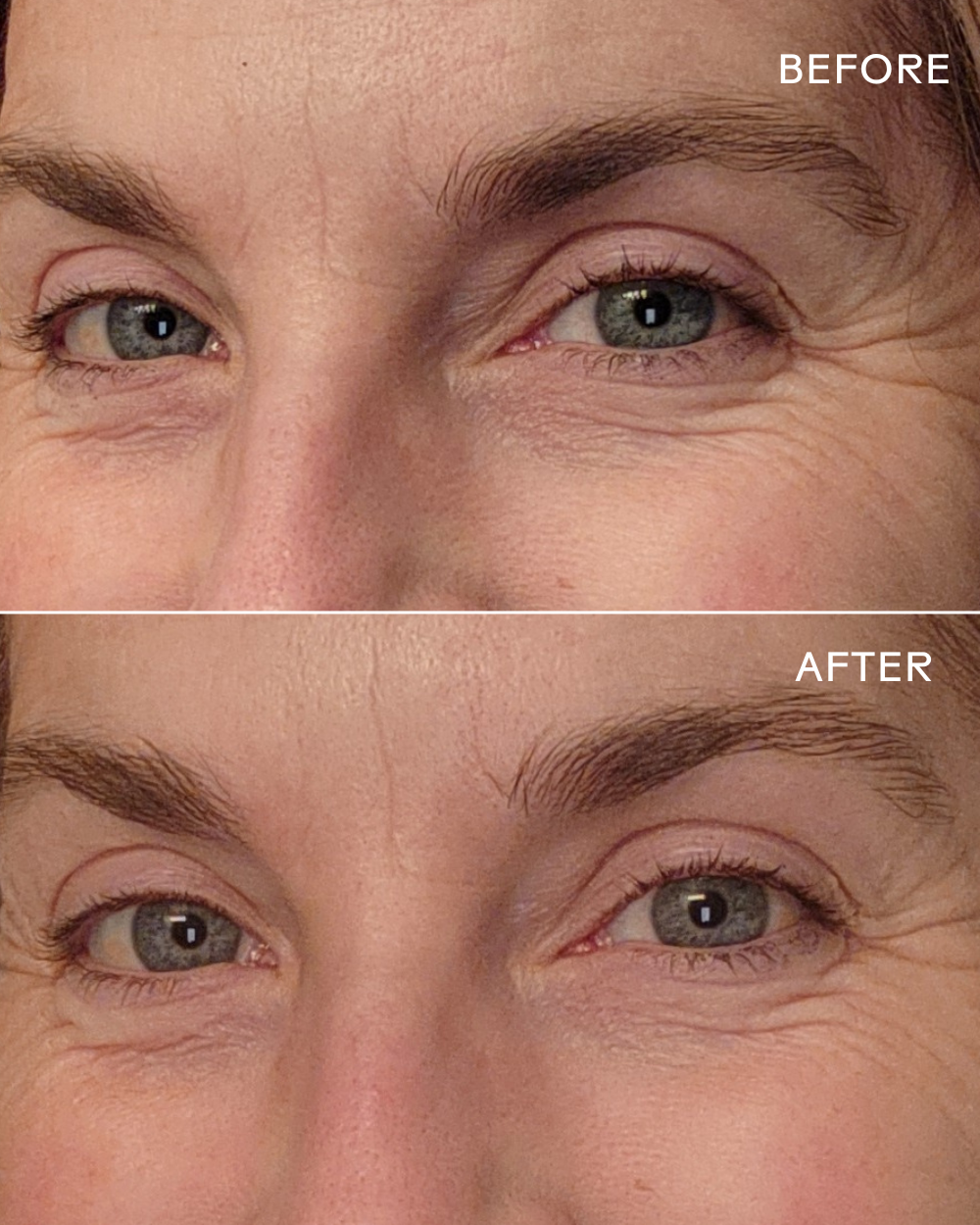 Three Ships - EyeHero™ Bio-Retinol Smoothing Eye Cream