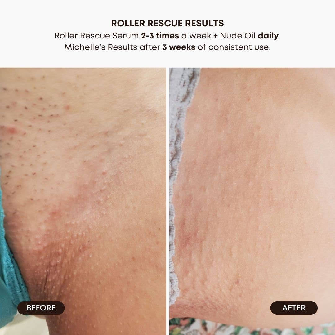 Bushbalm - Roller Rescue Ingrown Hair Soothing Serum