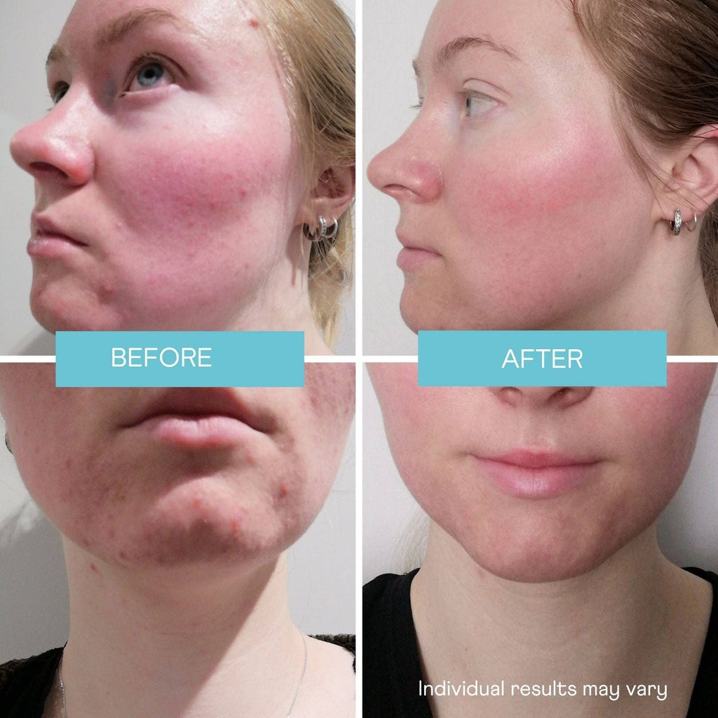 Woohoo Body - This Is Me Enzyme Exfoliating Mask: With Reusable Pump