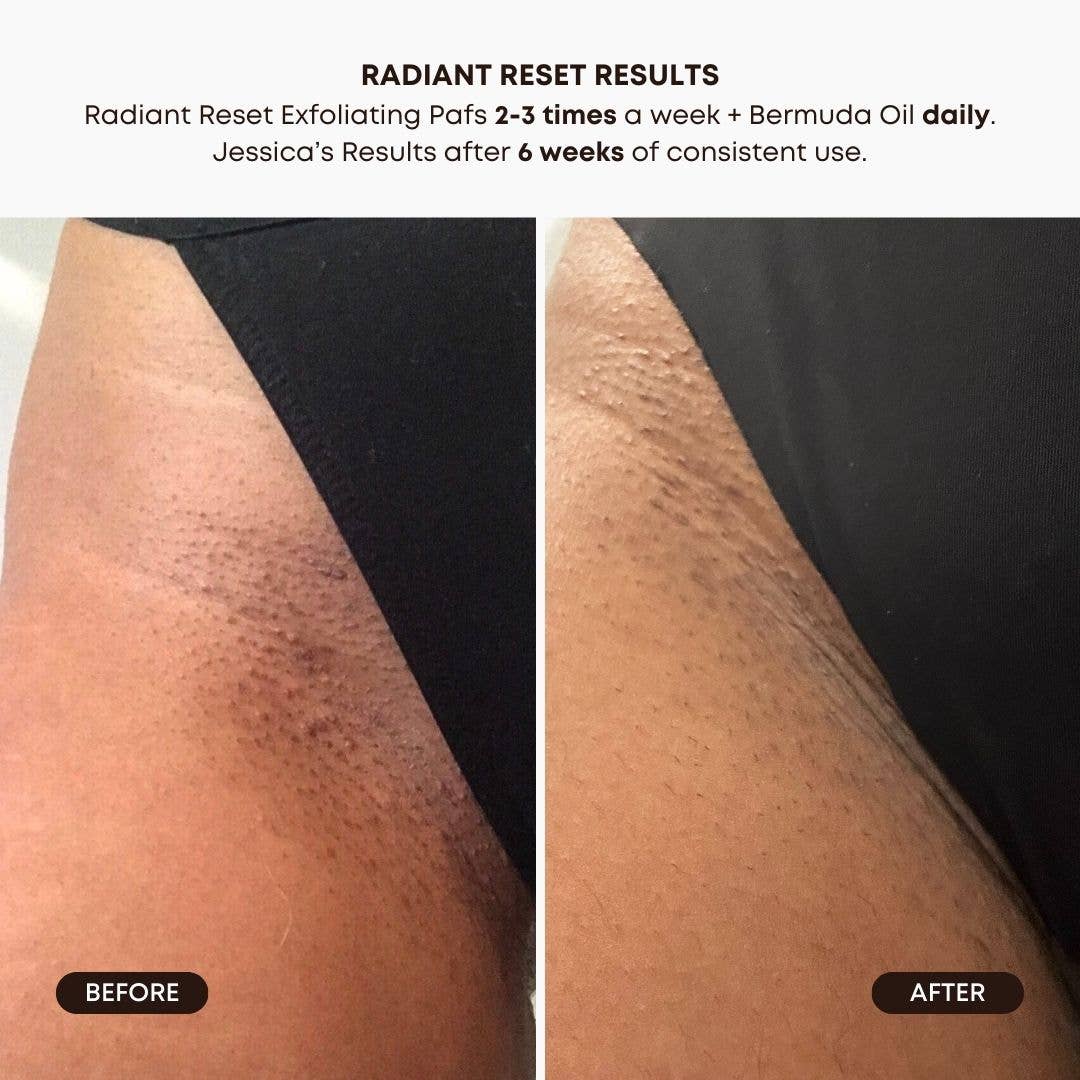 Bushbalm - Radiant Reset Exfoliating Toner Pads