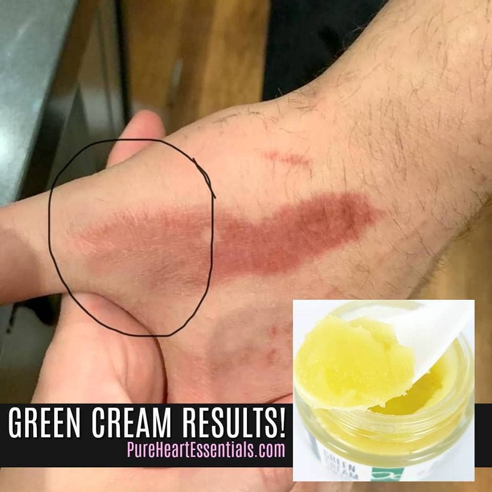 Pure Heart Essentials - Skincare - Rescue Balm (Formerly Green Cream)
